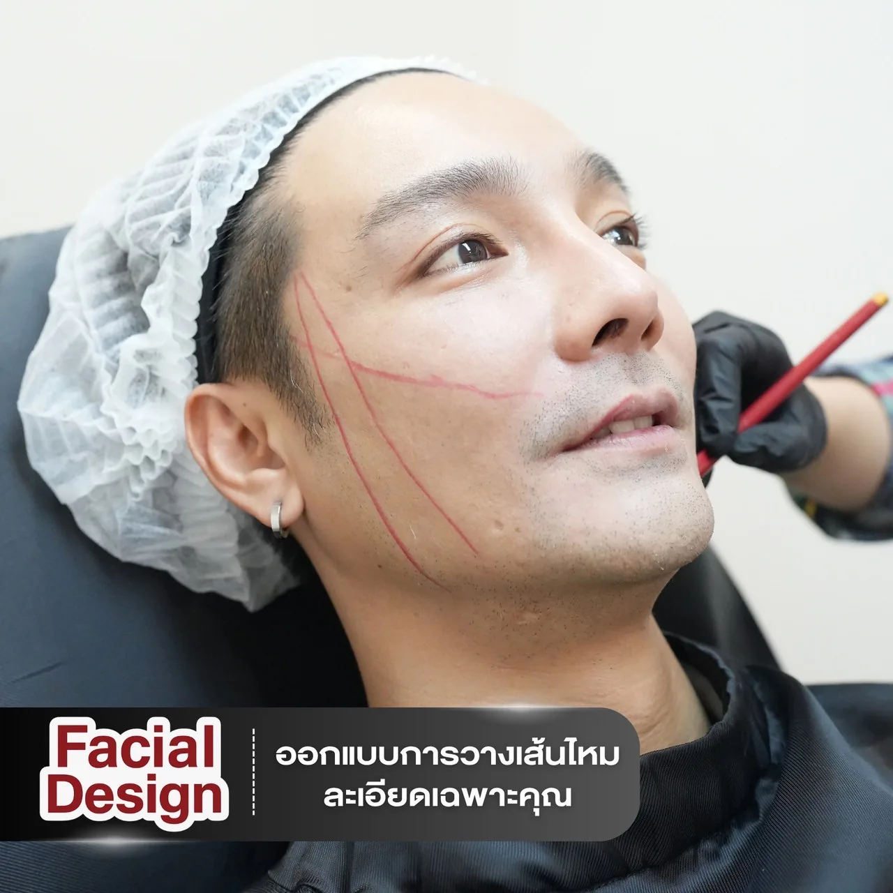 Facial Design — お顔立ちに合わせた繊細な糸の設計