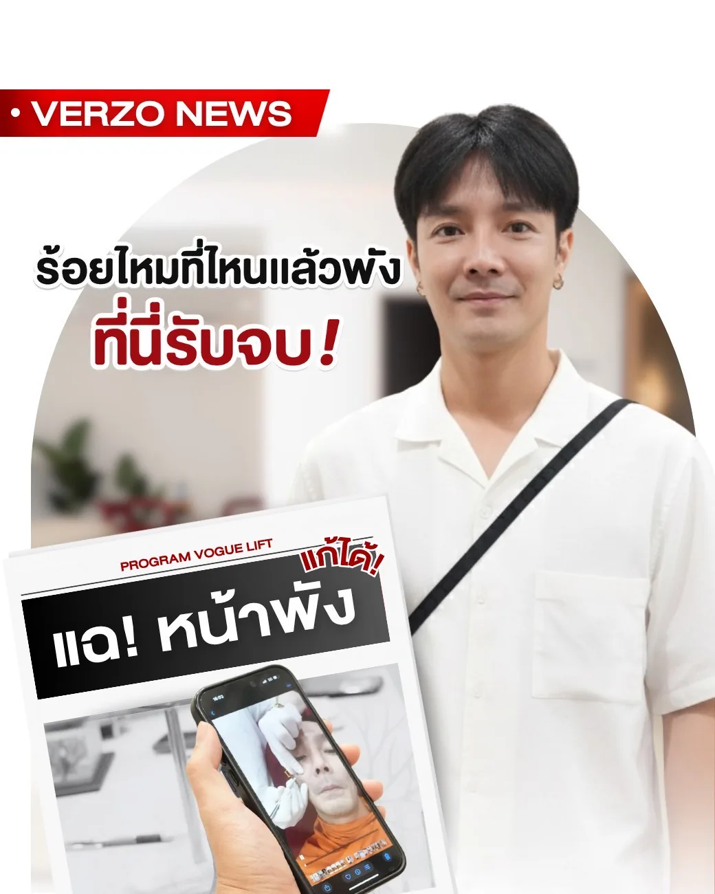 VERZO NEWS — 他院修正(リカバリー)症例のご紹介